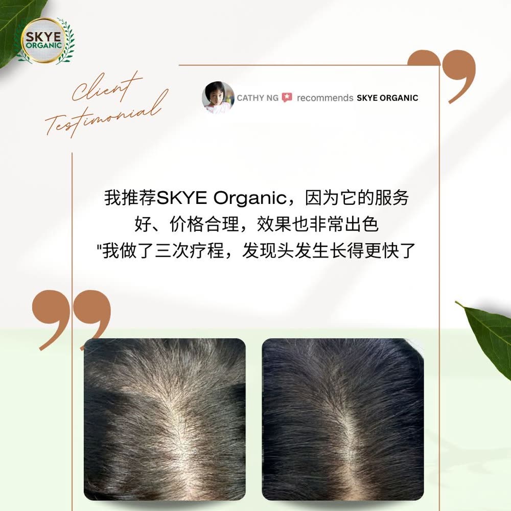 Client testimonial with fuller scalp after three treatments